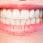 Wanneer is tanden bleken onveilig?