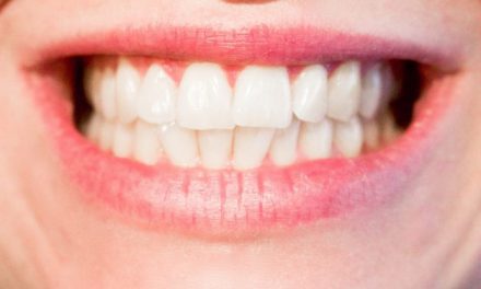Wanneer is tanden bleken onveilig?